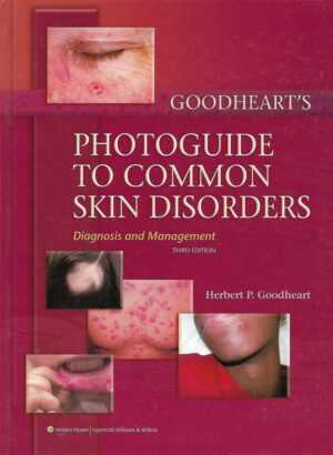 herbert p. goodheart: photoguide to common skin disorders