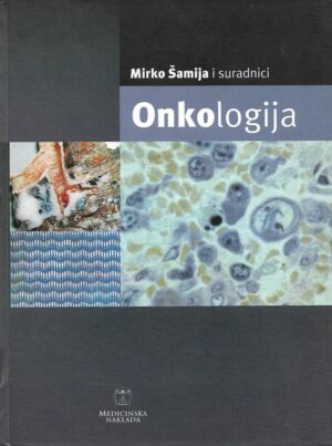 Mirko Šamlja i suradnici: Onkologija