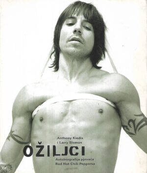 Anthony Kieds i Larry Sloman: Ožiljci