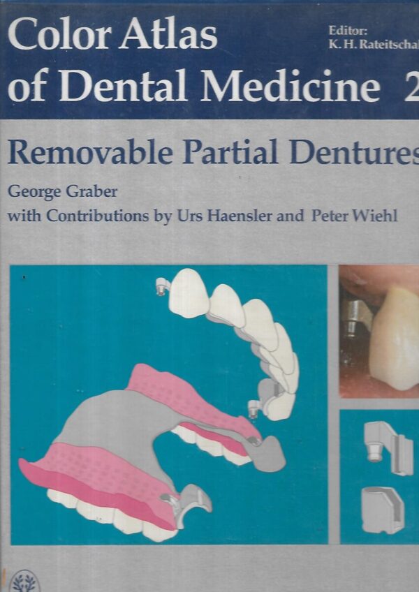 george graber: removable partial dentures -color atlas of dental medicine 2
