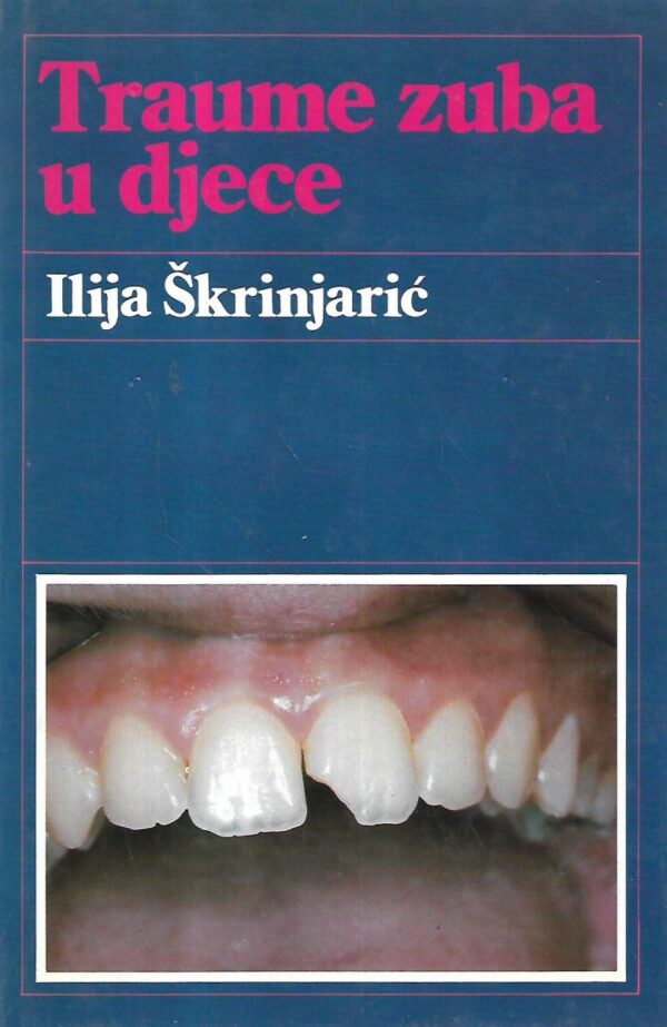 ilija Škrinjarić: traume zuba u djece