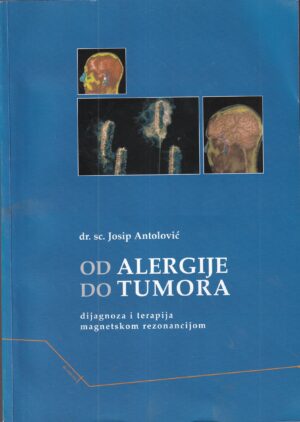 josip antolović: od alergije do tumora