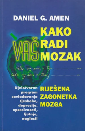 Daniel G. Amen: Kako radi vaš mozak