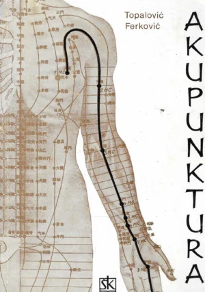Milan Topalović i Milan Ferković: Akupunktura