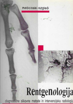 Rentgenologija - diagnostične slikovne metode in intervencijska radiologija