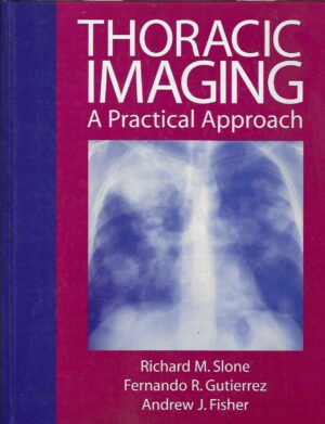 Skupina autora: Thoracic Imaging, A Practical Approach
