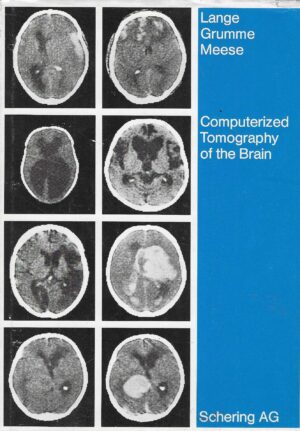 Lange, Grumme, Meese: Computerized Tomography of the Brain